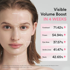 Abib product applied to smile lines demonstrating localized volume restoration benefit
