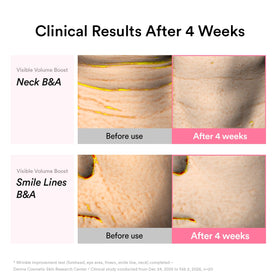 Abib cream applied to neck illustrating firming and refined texture appearance