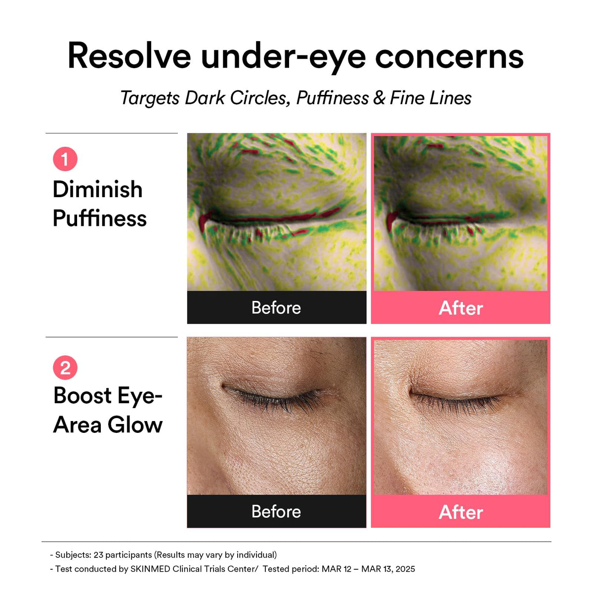 Abib patches applied to forehead and smile lines showing targeted multi-area care benefits