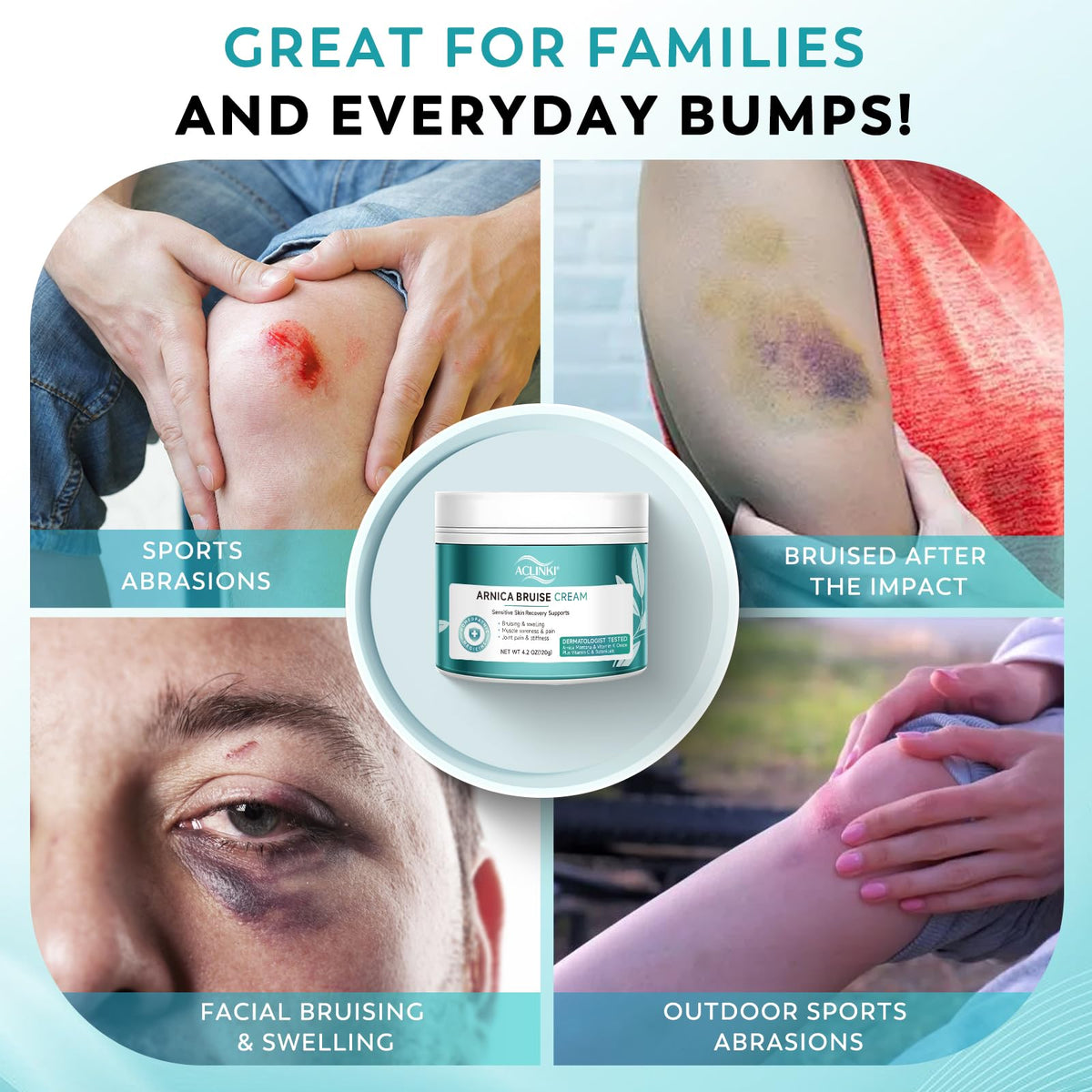 ACLINKI label ingredients zoom featuring Arnica and vitamins for visible support