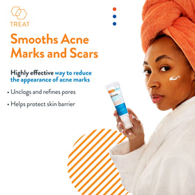 AcneFree serum texture droplet highlighting lightweight hydration