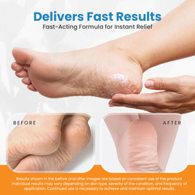 activelife cream being applied to a heel improving smoothness