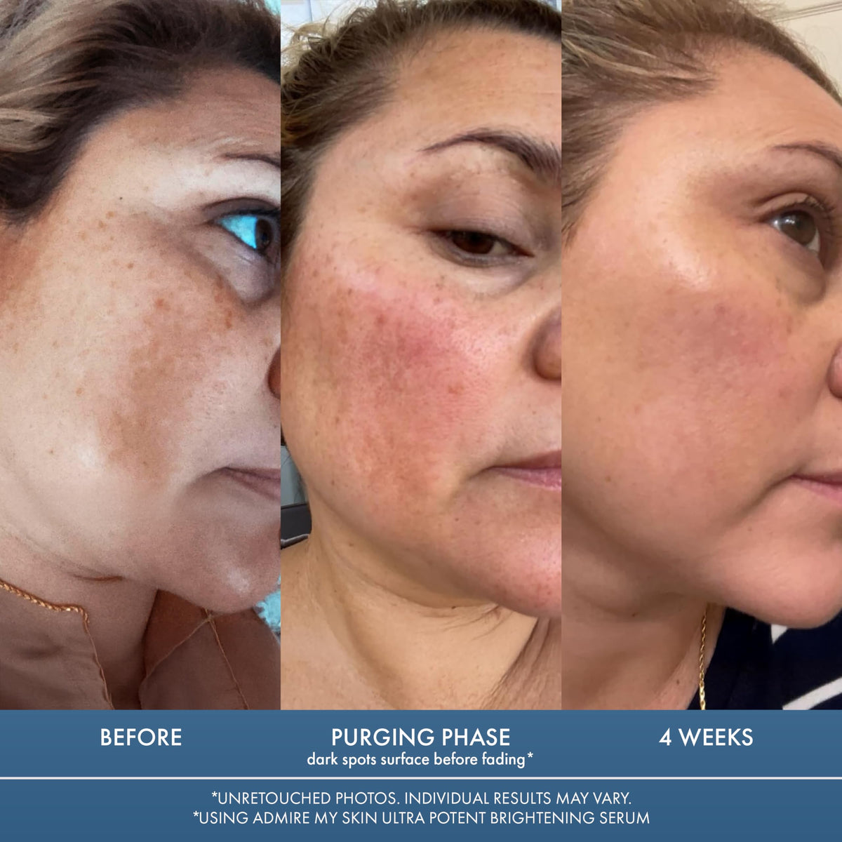 Admire My Skin ingredient list label highlighting actives like Synovea HR and kojic acid