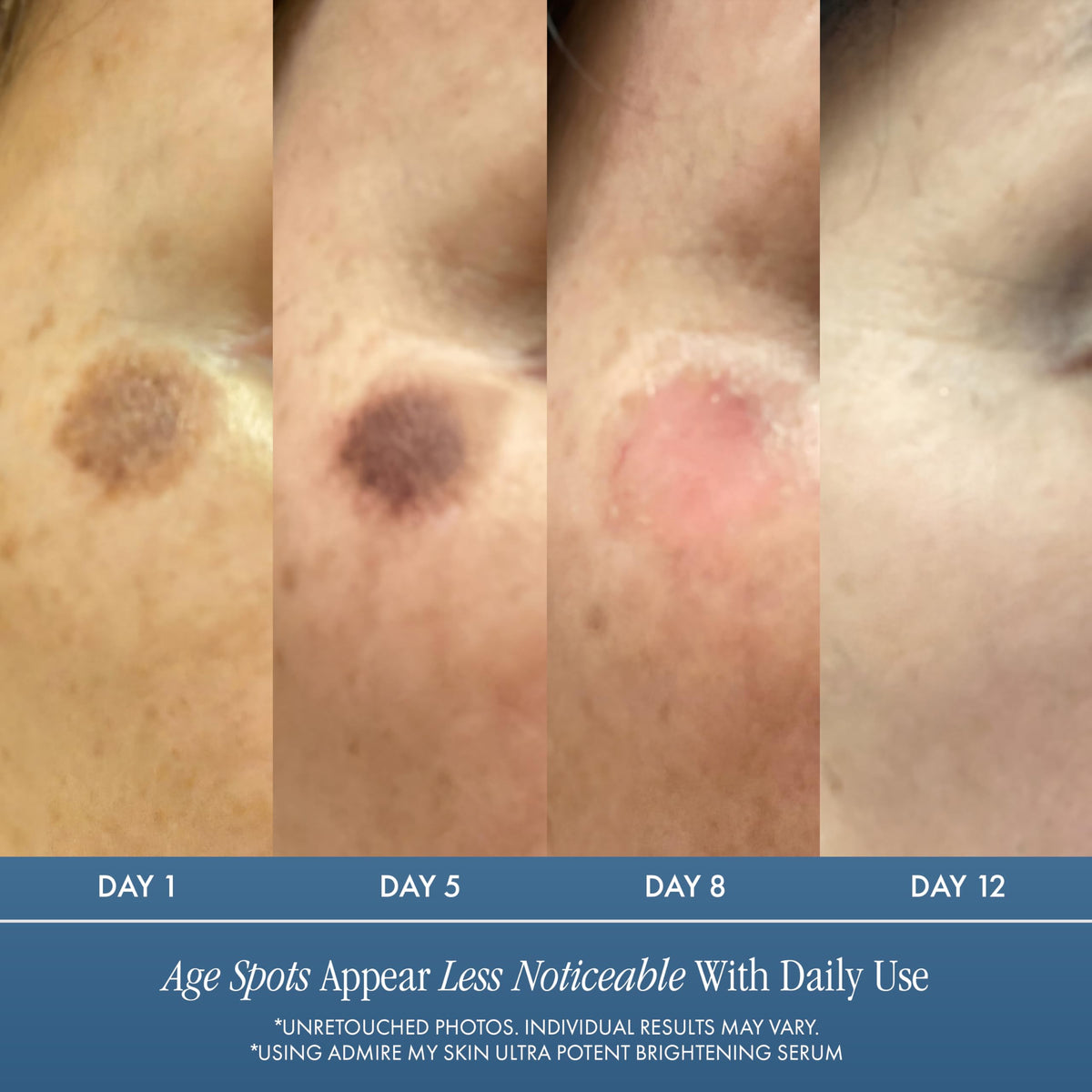 Admire My Skin serum texture close-up showing lightweight, fast-absorbing consistency