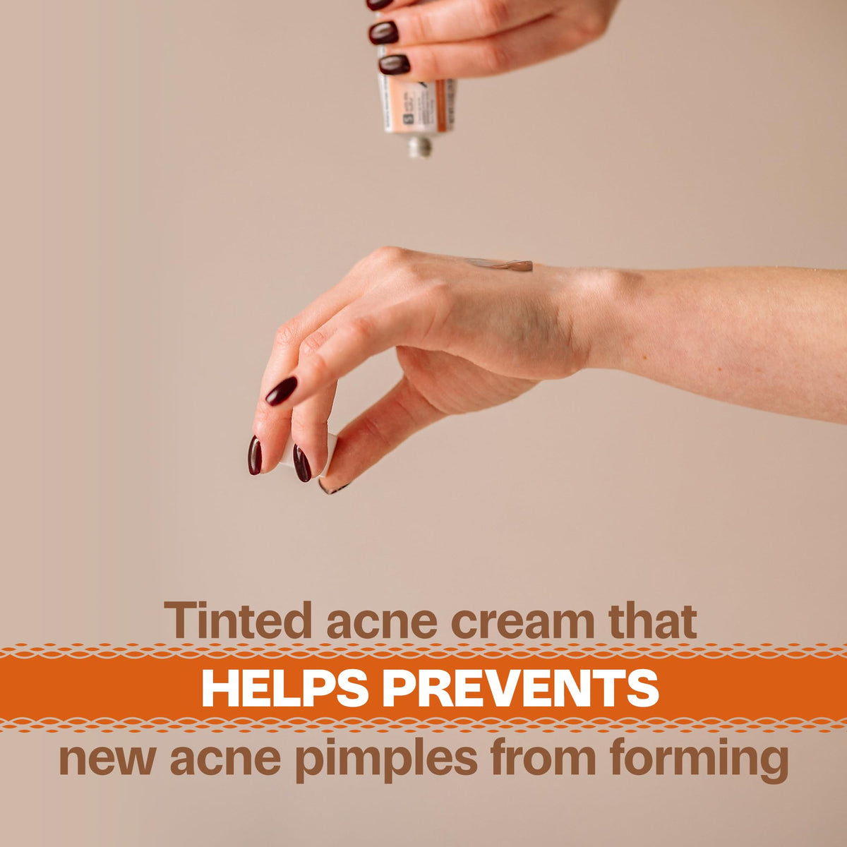 Close-up of Adult Acnomel tube label highlighting instructions