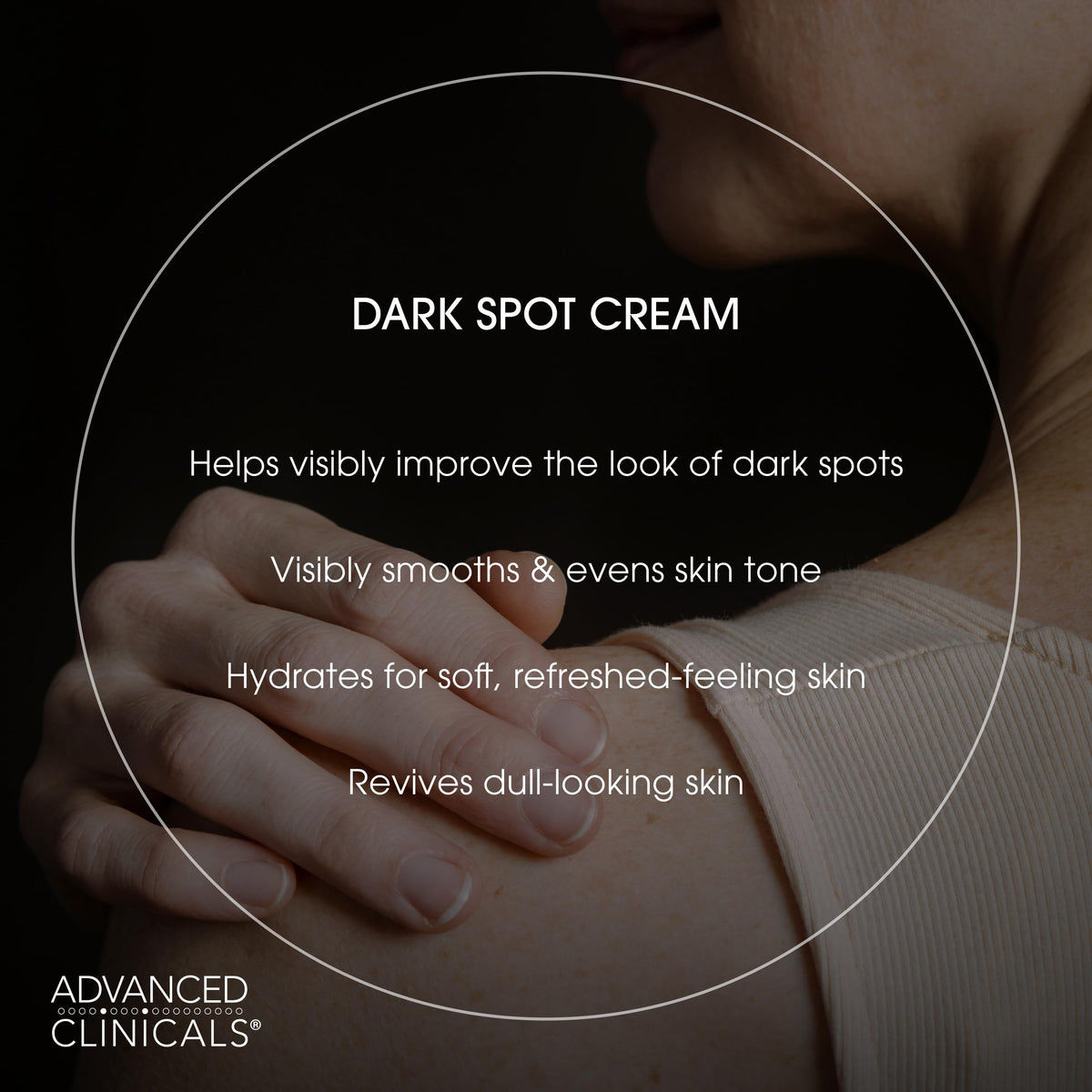 Advanced Clinicals cream applied on hand demonstrating evening skin tone benefit