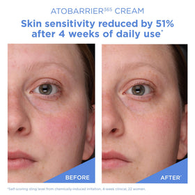 AESTURA applying cream to hand illustrating fast absorption and relief