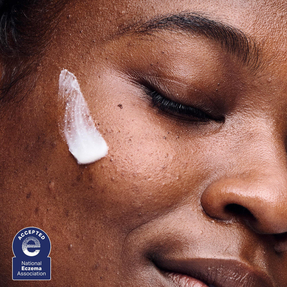 AESTURA used in clinical setting depicting post-procedure calming support