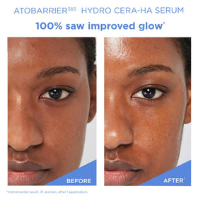 AESTURA graphic of ceramide and hyaluronic molecules illustrating barrier repair benefit