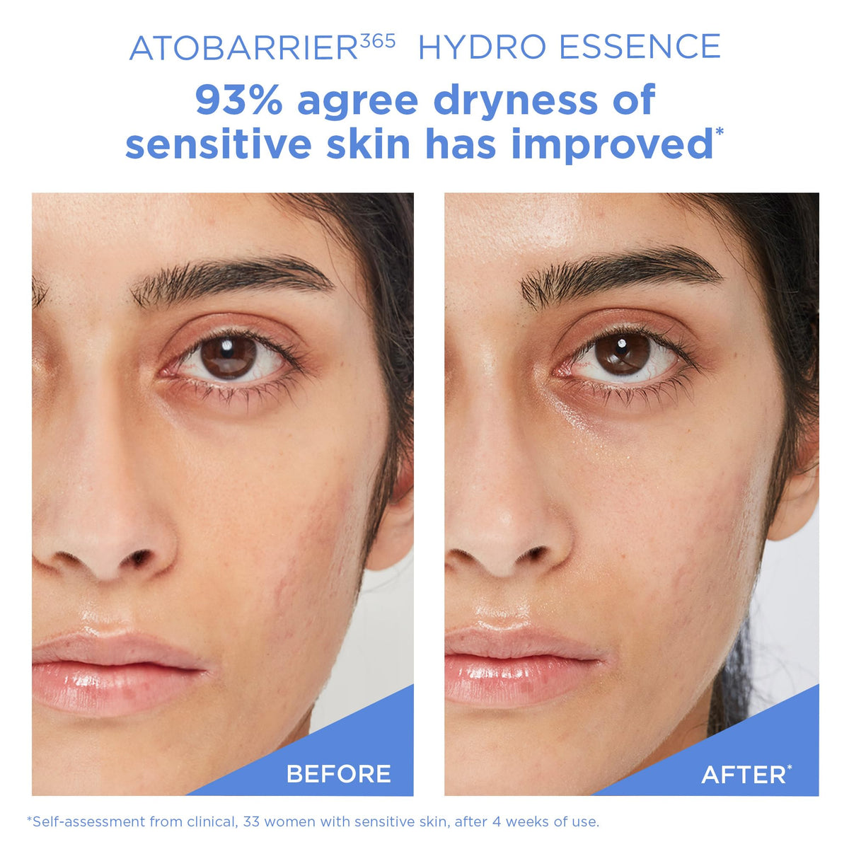 AESTURA product on hands being applied, showing smooth hydration finish