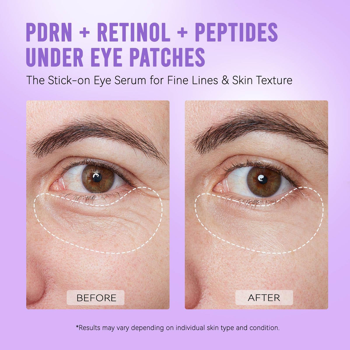 AILEORY patches applied under eye demonstrating stay-put comfort