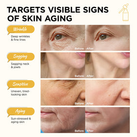 AIPILER Olivita before and after comparison indicating improved firmness