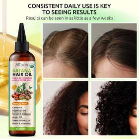 AKBAN comb drip applicator close-up for precise scalp application and easy use