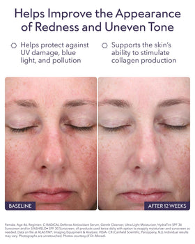 ALASTIN Skincare serum texture droplet illustrating smooth hydration and glow