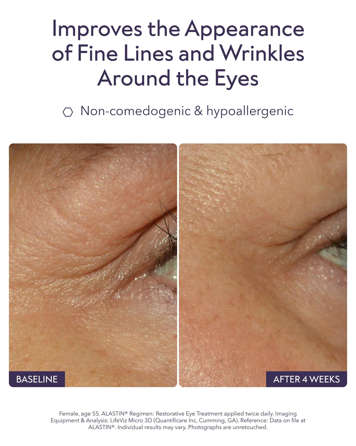 ALASTIN Skincare close-up of applicator dispensing precise eye treatment