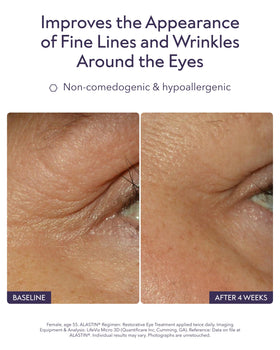 ALASTIN Skincare close-up of applicator dispensing precise eye treatment