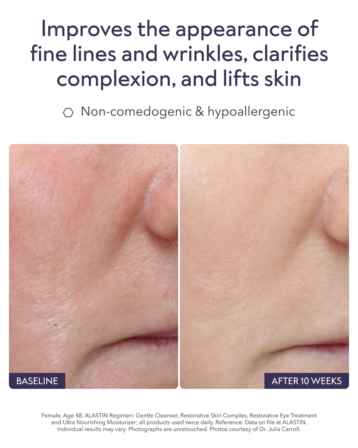 ALASTIN Skincare label close-up highlighting TriHex+ technology and active peptides
