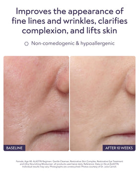 ALASTIN Skincare label close-up highlighting TriHex+ technology and active peptides