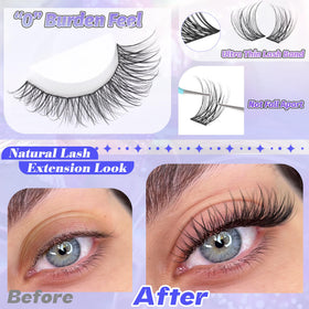 ALICE tray with mixed 8–16mm lengths, customizable styling benefit