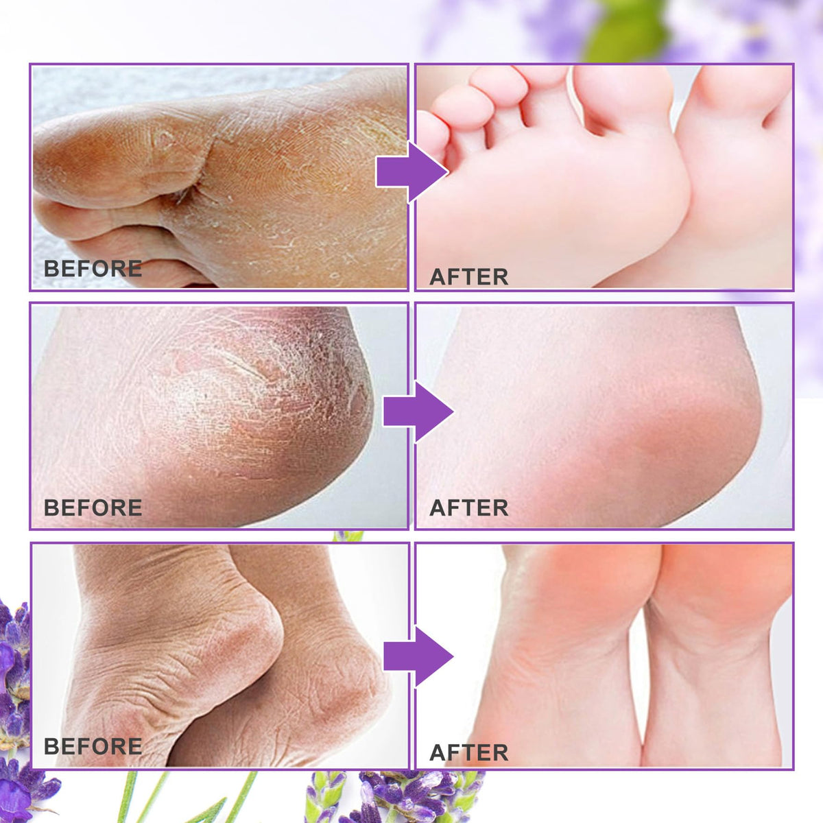 ALIVER rinsing feet after treatment showing clean wash-off and gentle care benefit