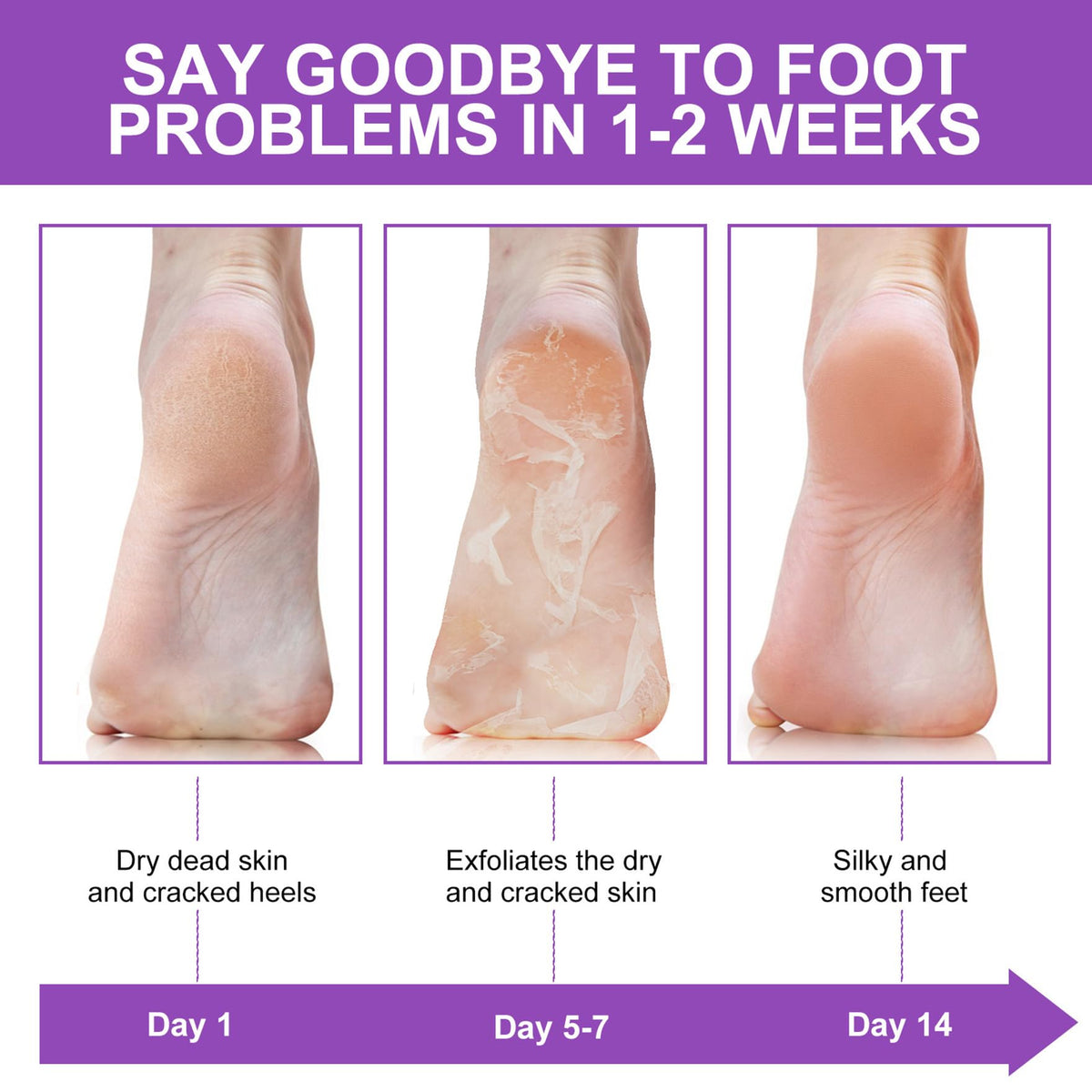 ALIVER smooth heel after treatment demonstrating visibly softer skin benefit