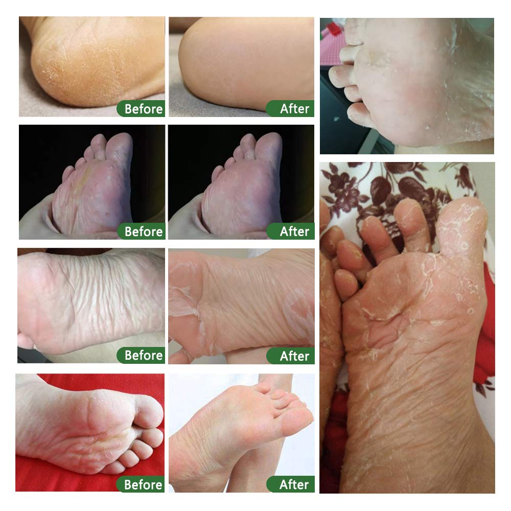 ALIVER single exfoliating sock close-up showing tear-off seal and fit benefit