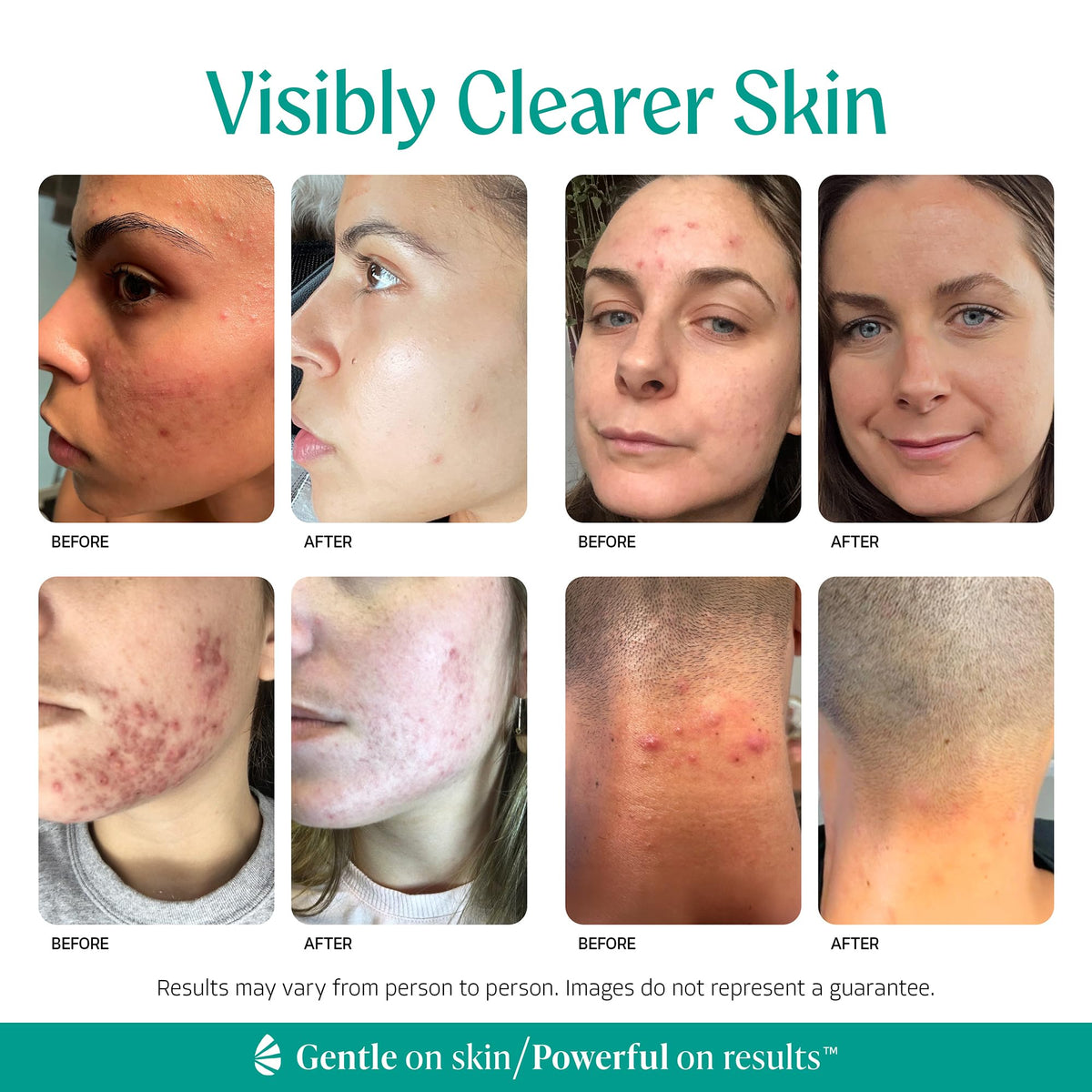 Almond Clear serum texture close-up demonstrating lightweight absorption benefit