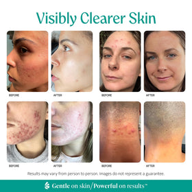 Almond Clear serum texture close-up demonstrating lightweight absorption benefit