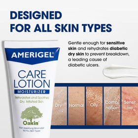 AMERIGEL results on heels showing softened skin and improved texture scale comparison