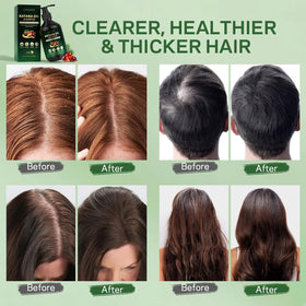 AMOADO rosemary and tea tree ingredients, emphasizes scalp-refreshing properties