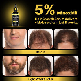 andelusita scalp application before and after illustration showing improved density
