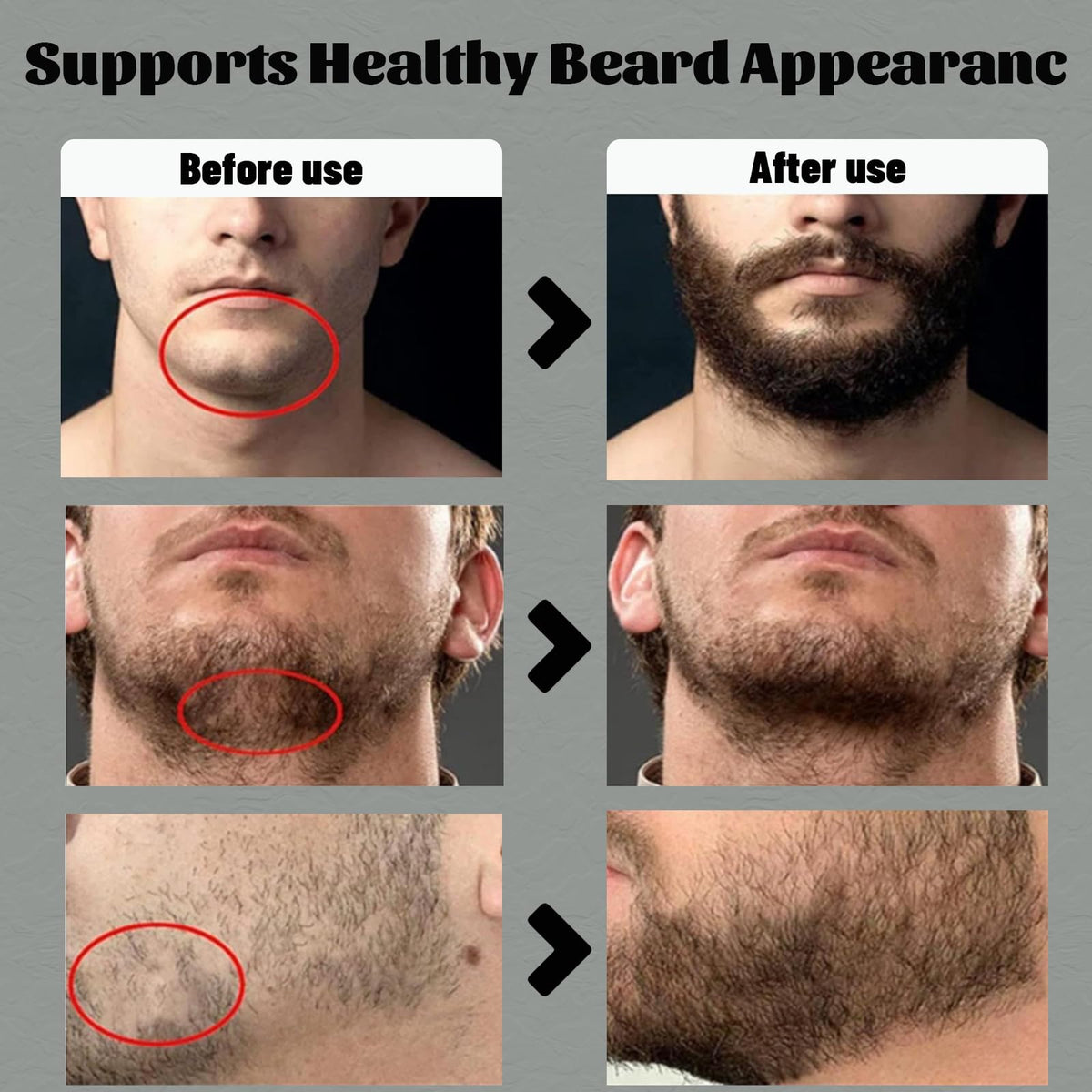 apolo cosmetics before and after beard showing fuller, neater appearance benefit