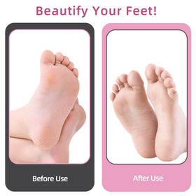 APRELM used during at-home pedicure illustrating efficient callus smoothing