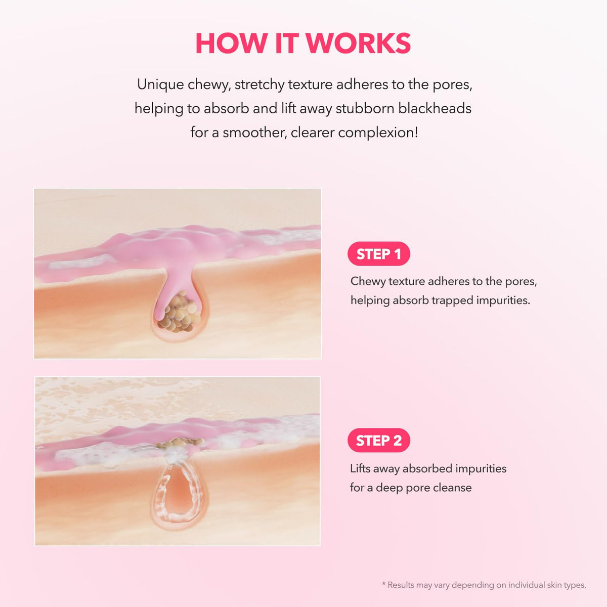 APRILSKIN before and after pores view highlighting reduced visible impurities
