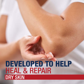 Applying Aquaphor to a dry heel showing moisturizing repair support