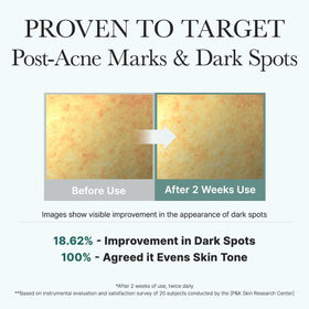 ARENCIA night routine staging with product beside pillow implying overnight use