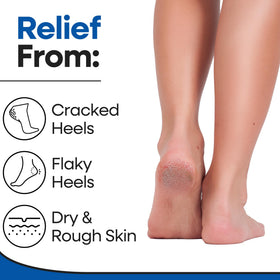 ARMSTRONG AMERICA open-toe design for comfortable airflow