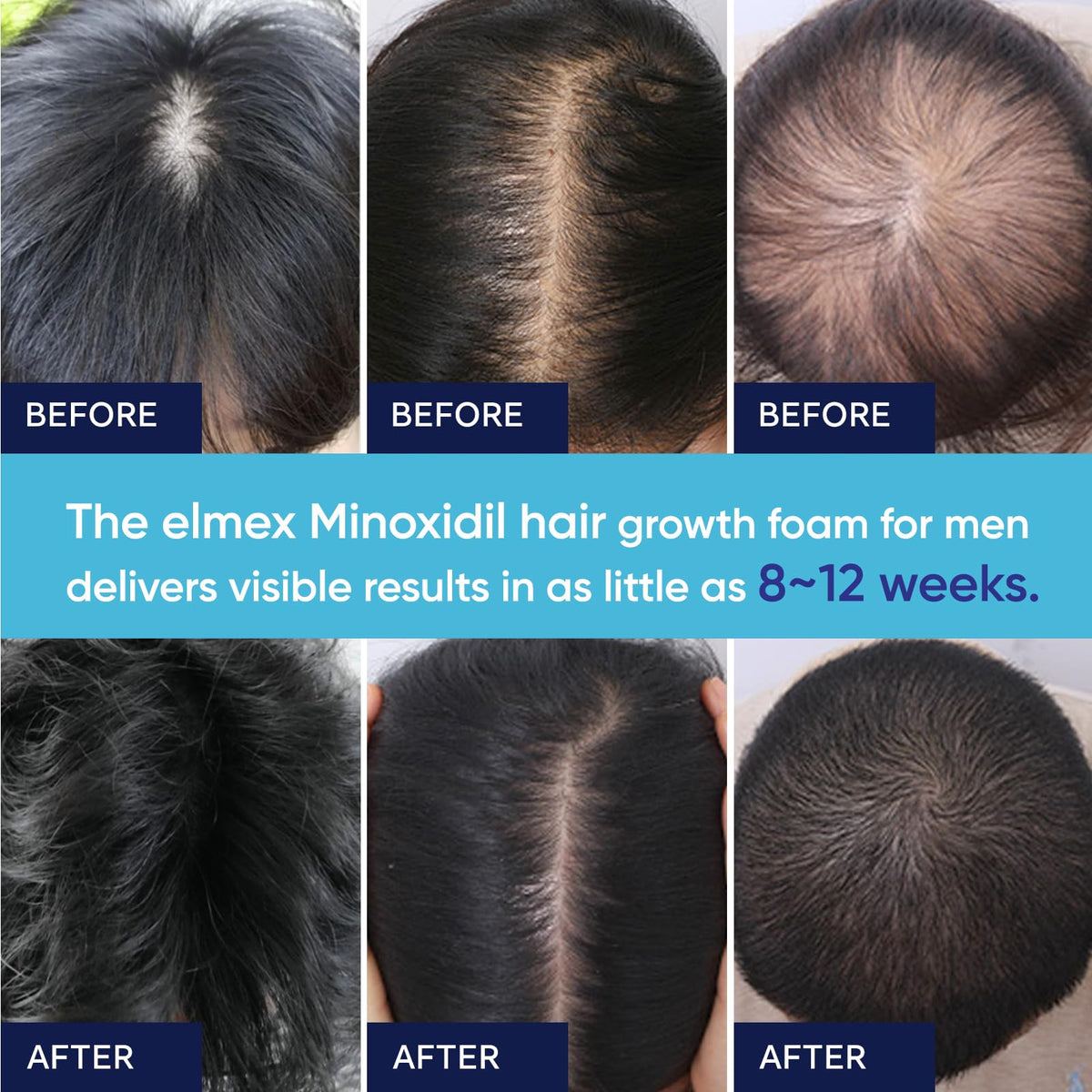 Artimore applied to beard area demonstrating targeted application benefit