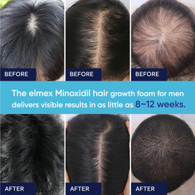 Artimore applied to beard area demonstrating targeted application benefit