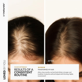 Artnaturals applied to hairline demonstrating targeted edge strengthening