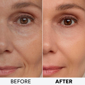 Arvesa before and after sample demonstrating smoother, firmer appearance
