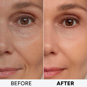 Arvesa cream applied to neck and décolleté illustrating firming and hydrating benefit
