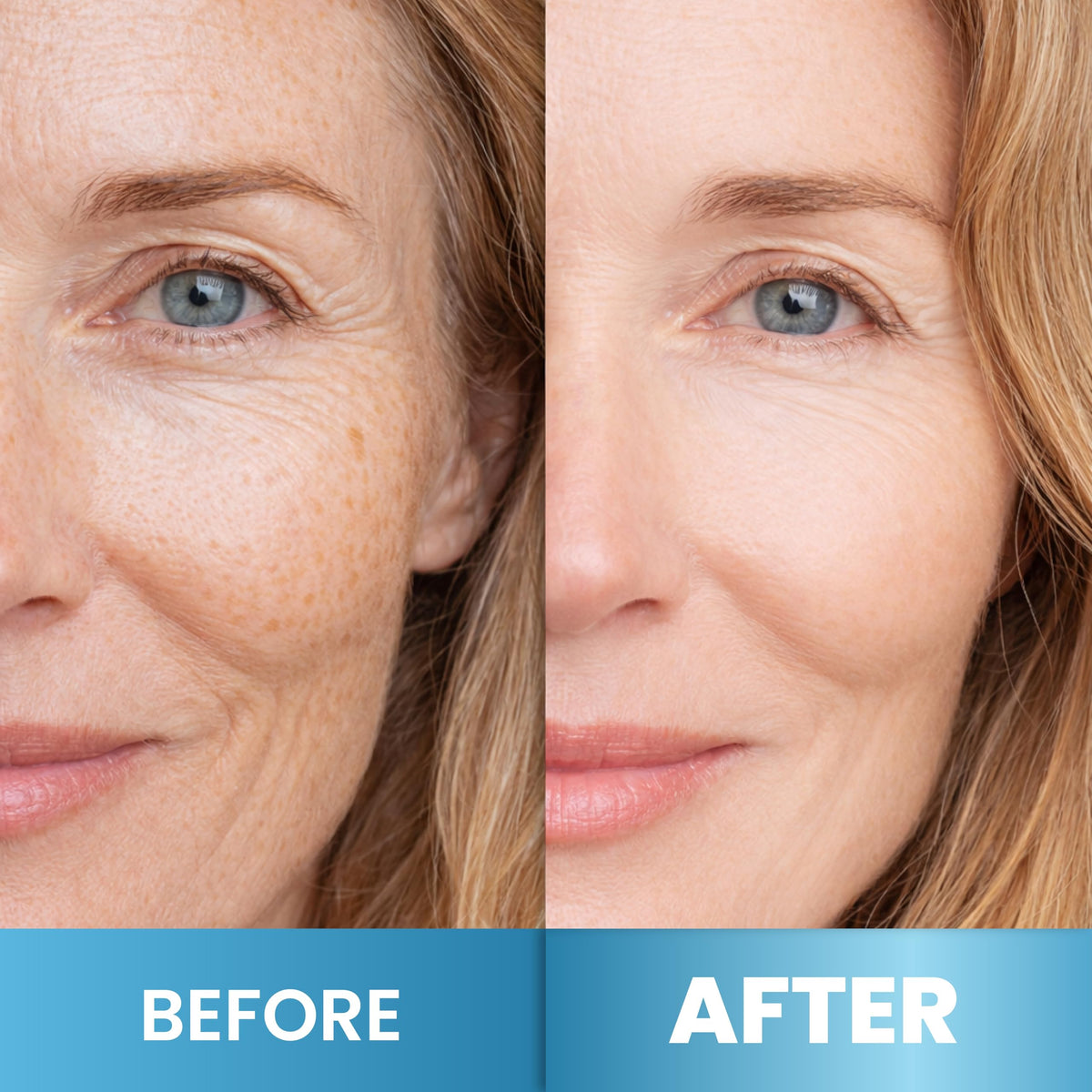 Arvesa applied to jawline and neck demonstrating smoothing action