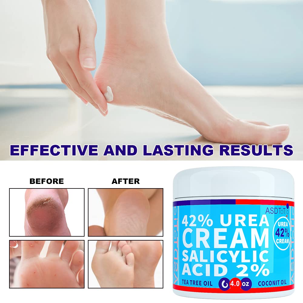 ASDToTio before and after heel photo demonstrating smoother, reduced roughness
