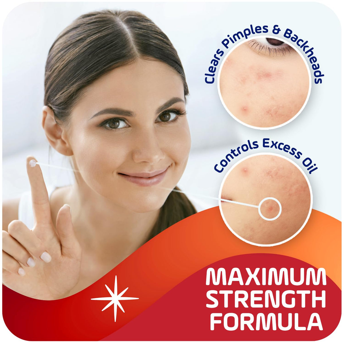 Asepxia spot cream on fingertip ready for precise blemish application