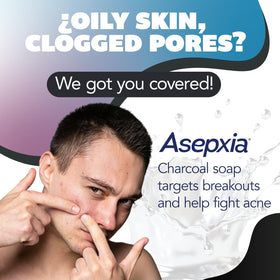 Asepxia bar close-up texture highlighting charcoal and solid form