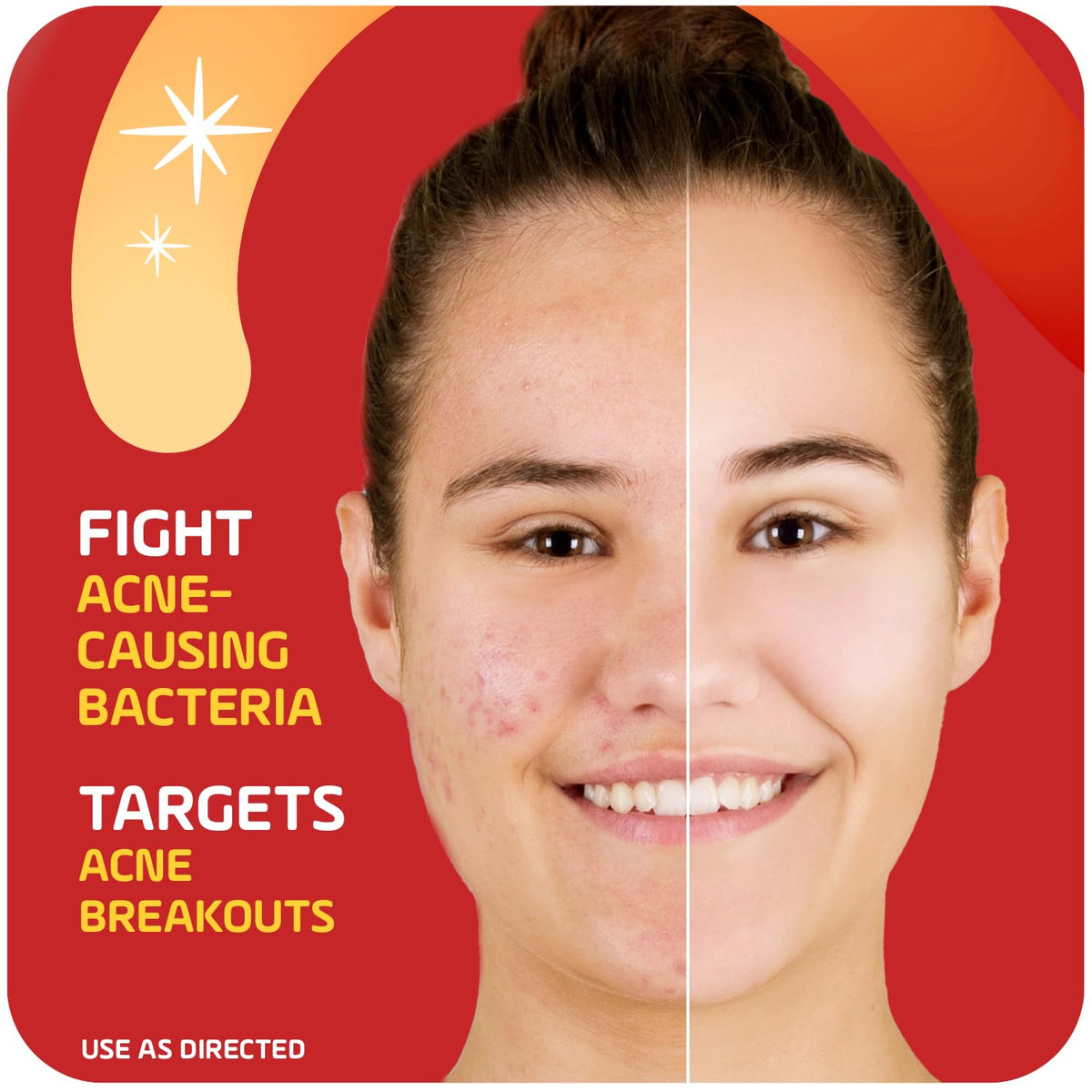 Asepxia applied to cheek blemish demonstrating targeted treatment benefit