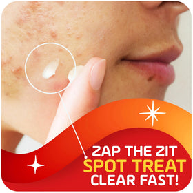 Asepxia cream texture close-up highlighting thin non-greasy consistency