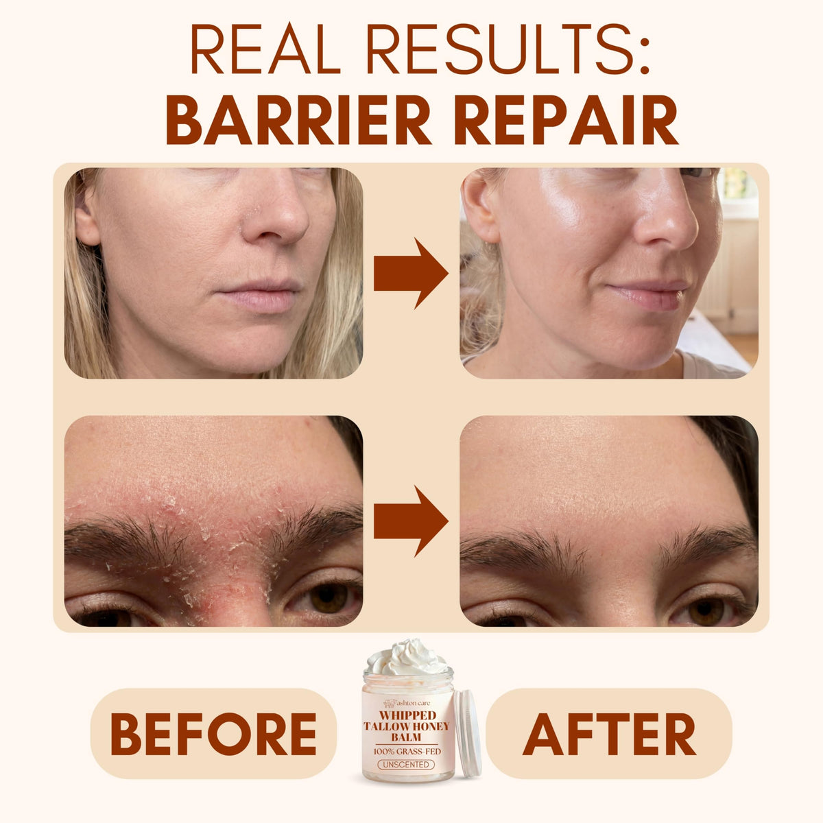 ASHTON CARE balm warming between fingers ready to apply for better hydration