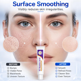 Aufdzceh ingredient pipette highlighting active acids and targeted clarifying action